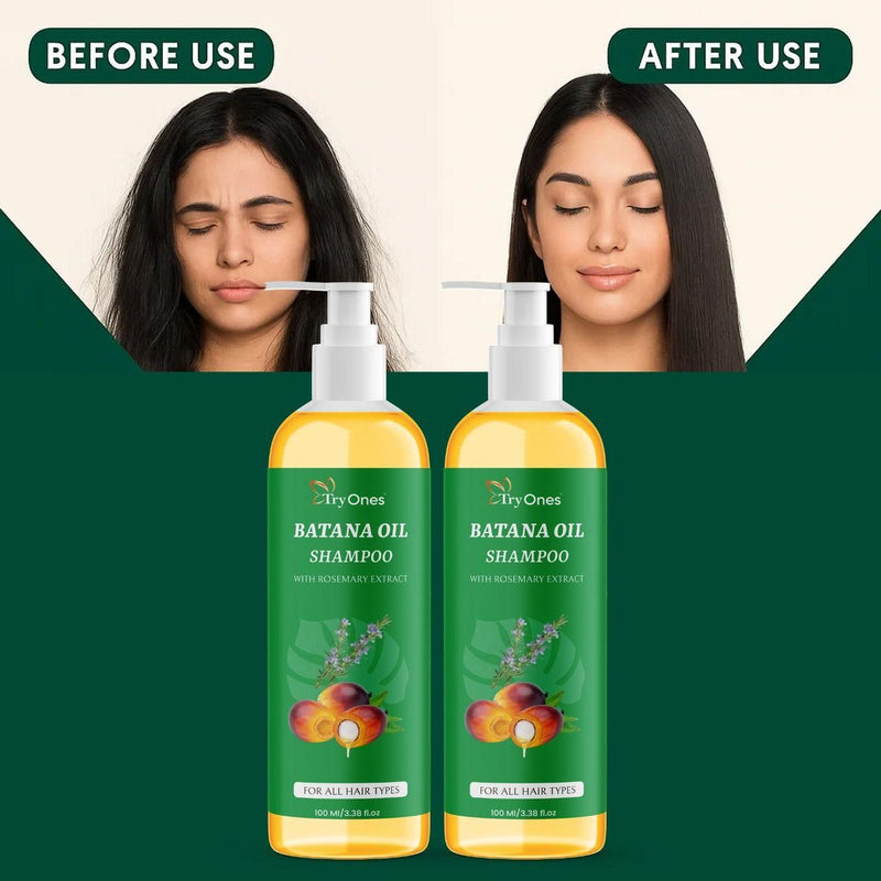 Batana Oil Shampoo for Hair Growth with Rosemary Extract 🌱✨ (100% Pure & Natural) - Buy 1 Get 1 Free🔥🔥